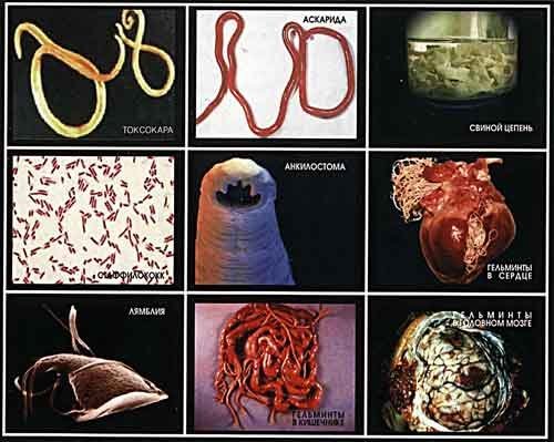 Atopitscheski die Hautentzündung und die Parasiten