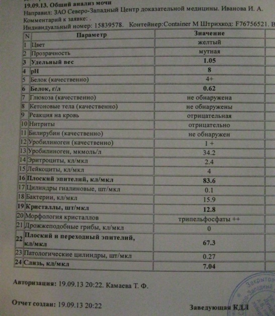 Общий анализ мочи (с микроскопией осадка)