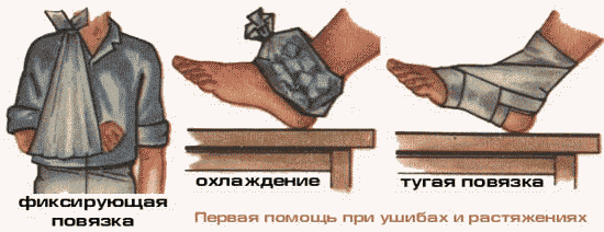 вывих ноги опухла что делать